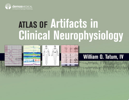 Atlas of Artifacts in Clinical Neurophysiology