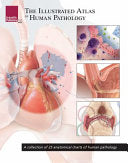 The Illustrated Atlas of Human Pathology