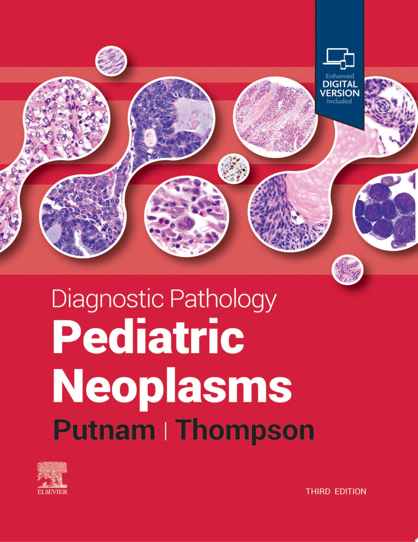 Diagnostic Pathology: Pediatric Neoplasms, 3rd edition