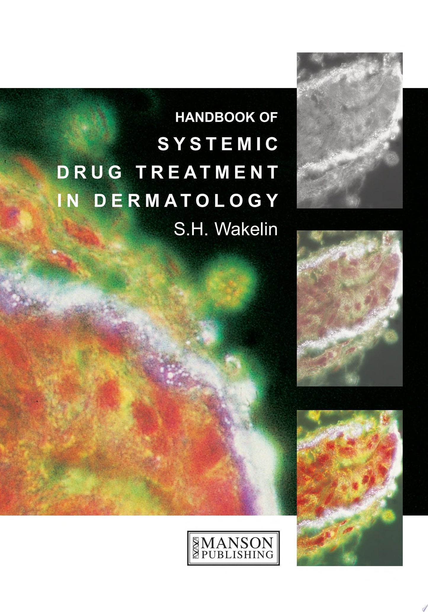 Handbook of Systemic Drug Treatment in Dermatology, 3rd Edition