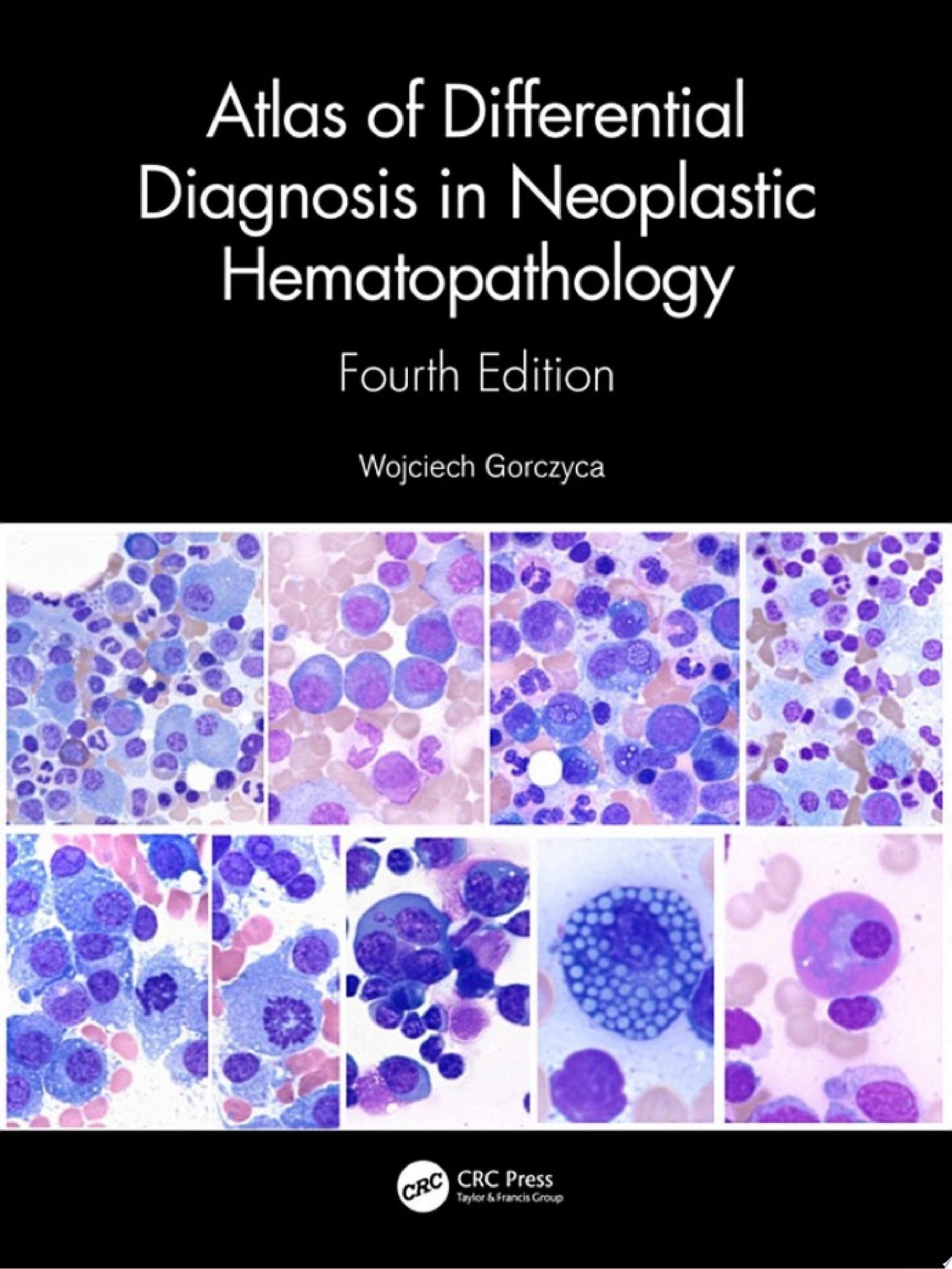 Atlas of Differential Diagnosis in Neoplastic Hematopathology, 4th Edition