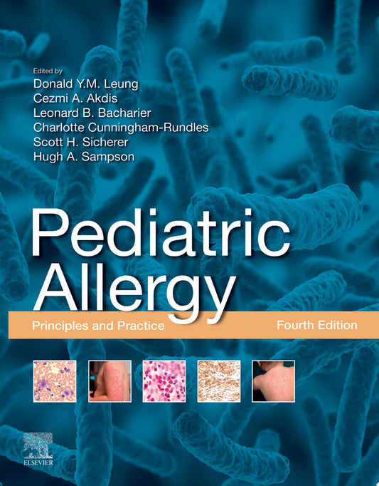 Textbook of Pediatric Allergy
