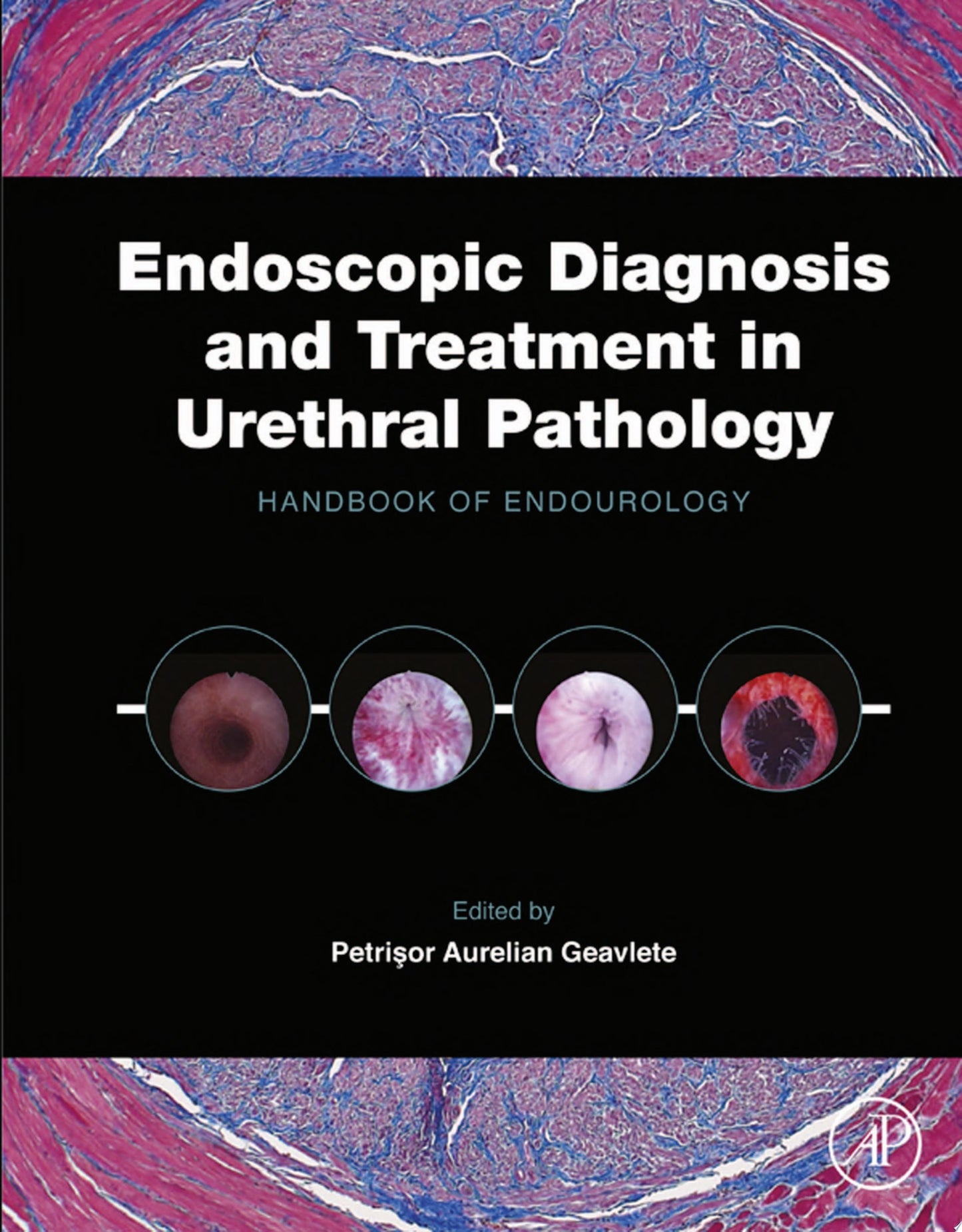 Endoscopic Diagnosis and Treatment in Urethral Pathology: Handbook of Endourology