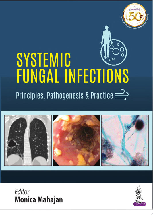 Systemic Fungal Infections: Principles, Pathogenesis & Practice