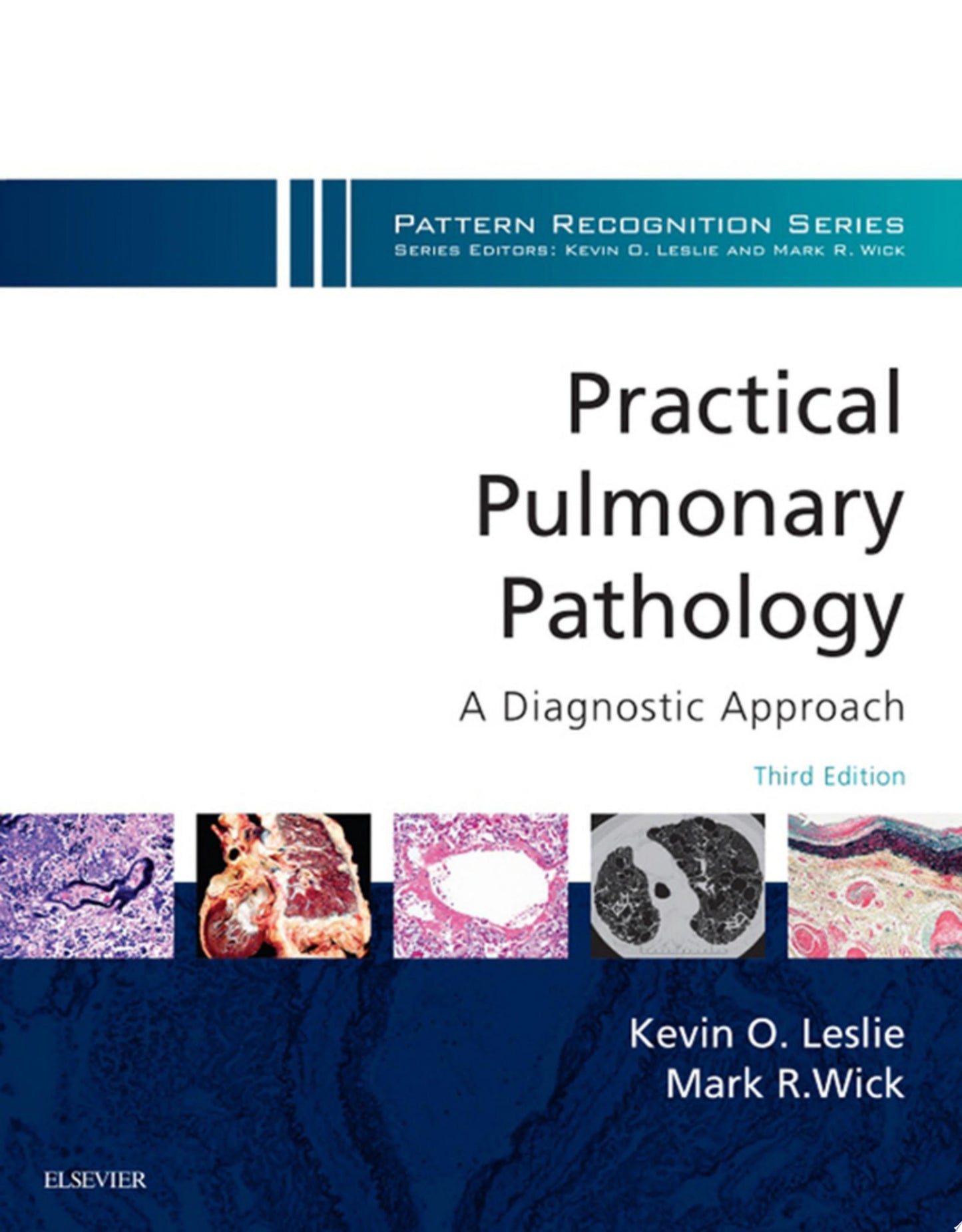 Practical Pulmonary Pathology: A Diagnostic Approach: A Volume in the Pattern Recognition Series, Expert Consult: Online and Print 2nd