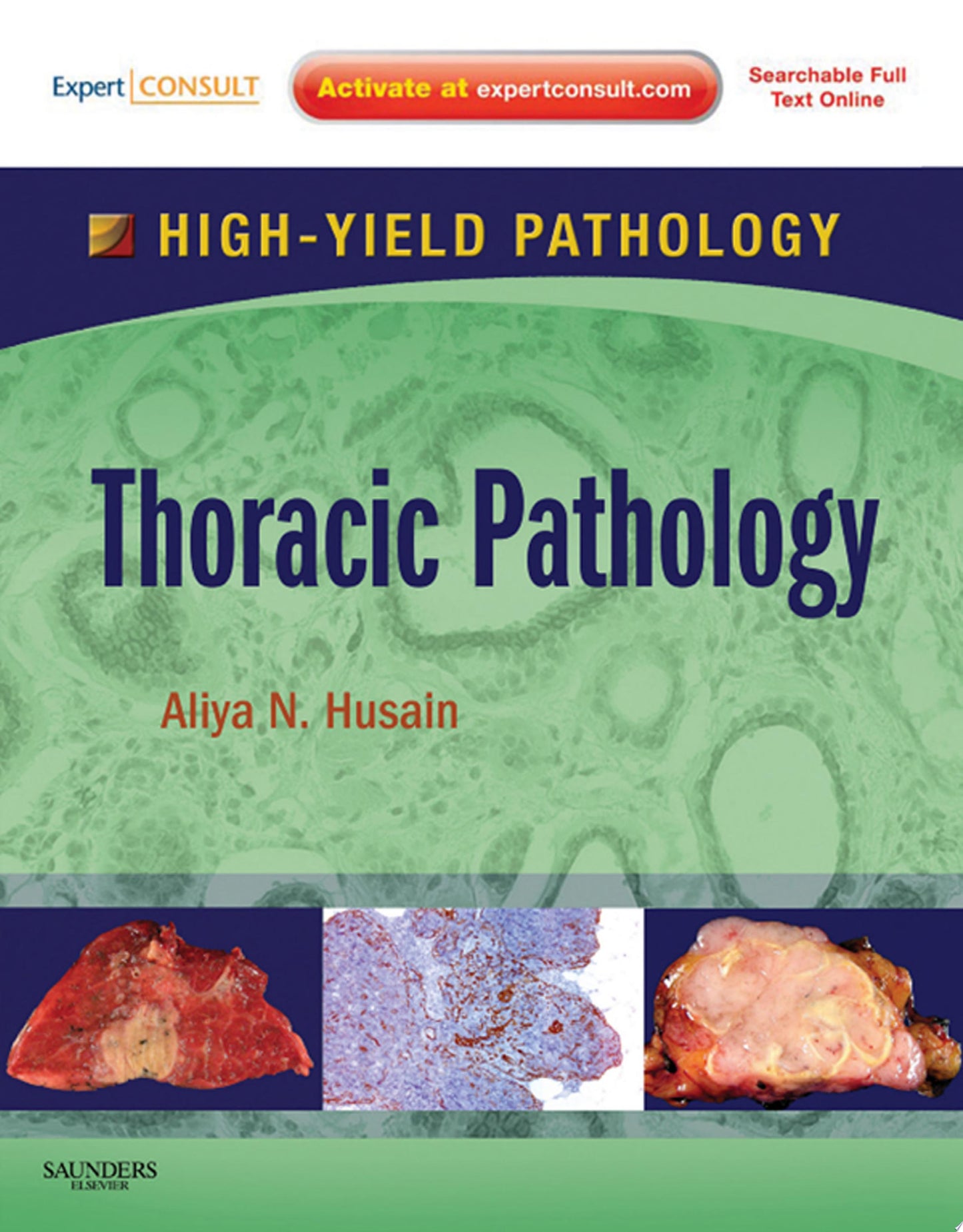 Thoracic Pathology: A Volume in the High Yield Pathology Series
