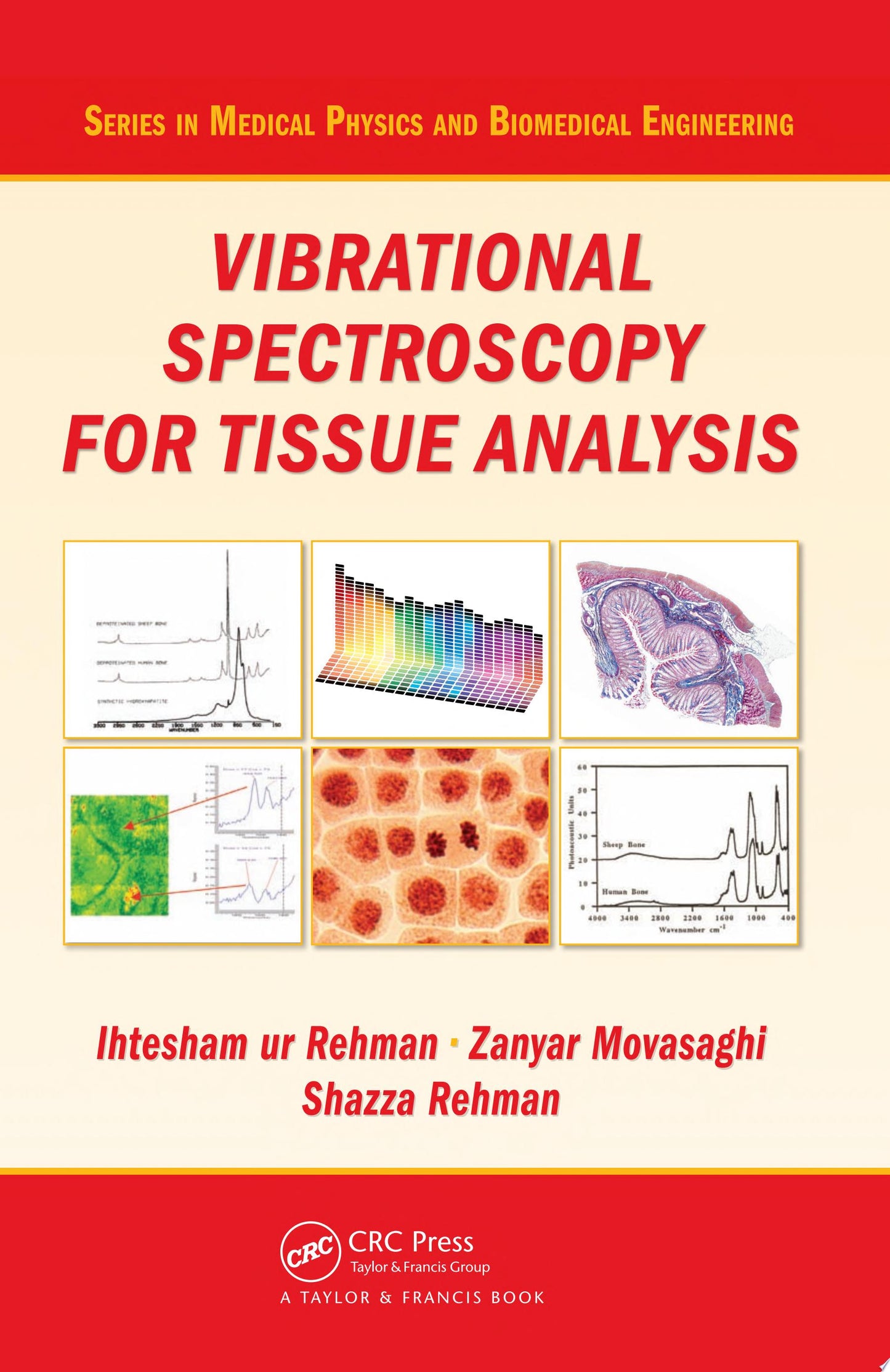Vibrational Spectroscopy for Tissue Analysis